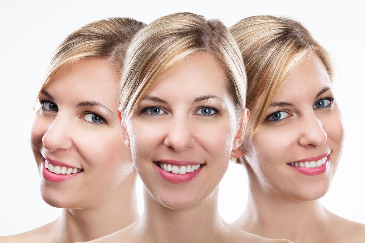 3 Considerations for a Complete Smile Makeover