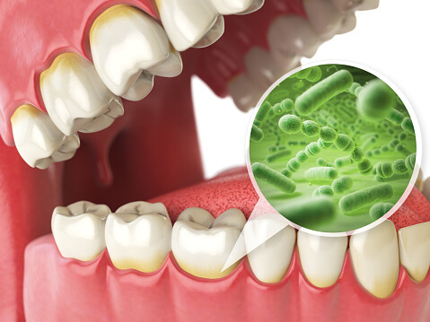 Dental Health and Hear disease