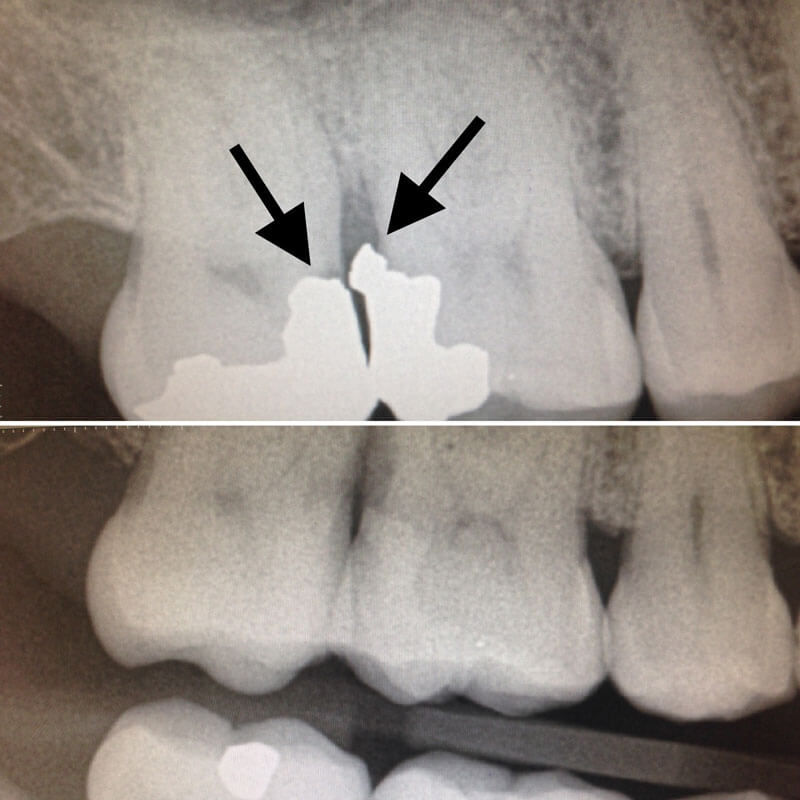 Before and After