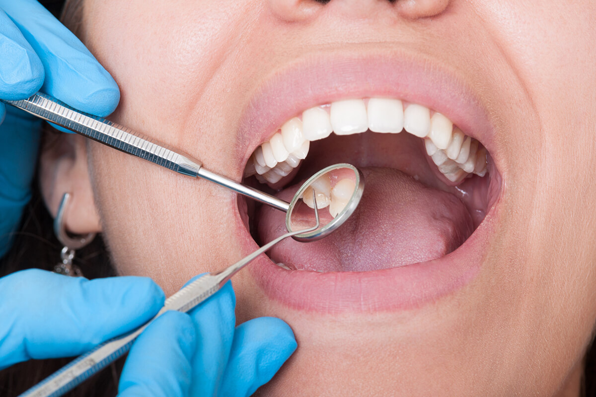 dentist works in a patient's mouth