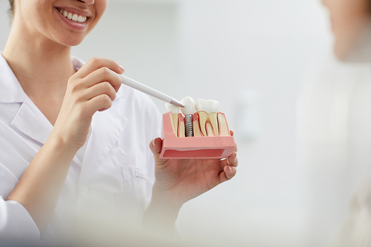 Top 5 Benefits of Choosing Dental Implants Over Dentures