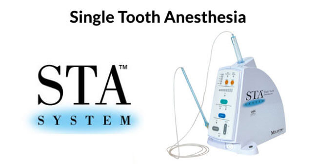 Single Tooth Anesthesia in West Milford