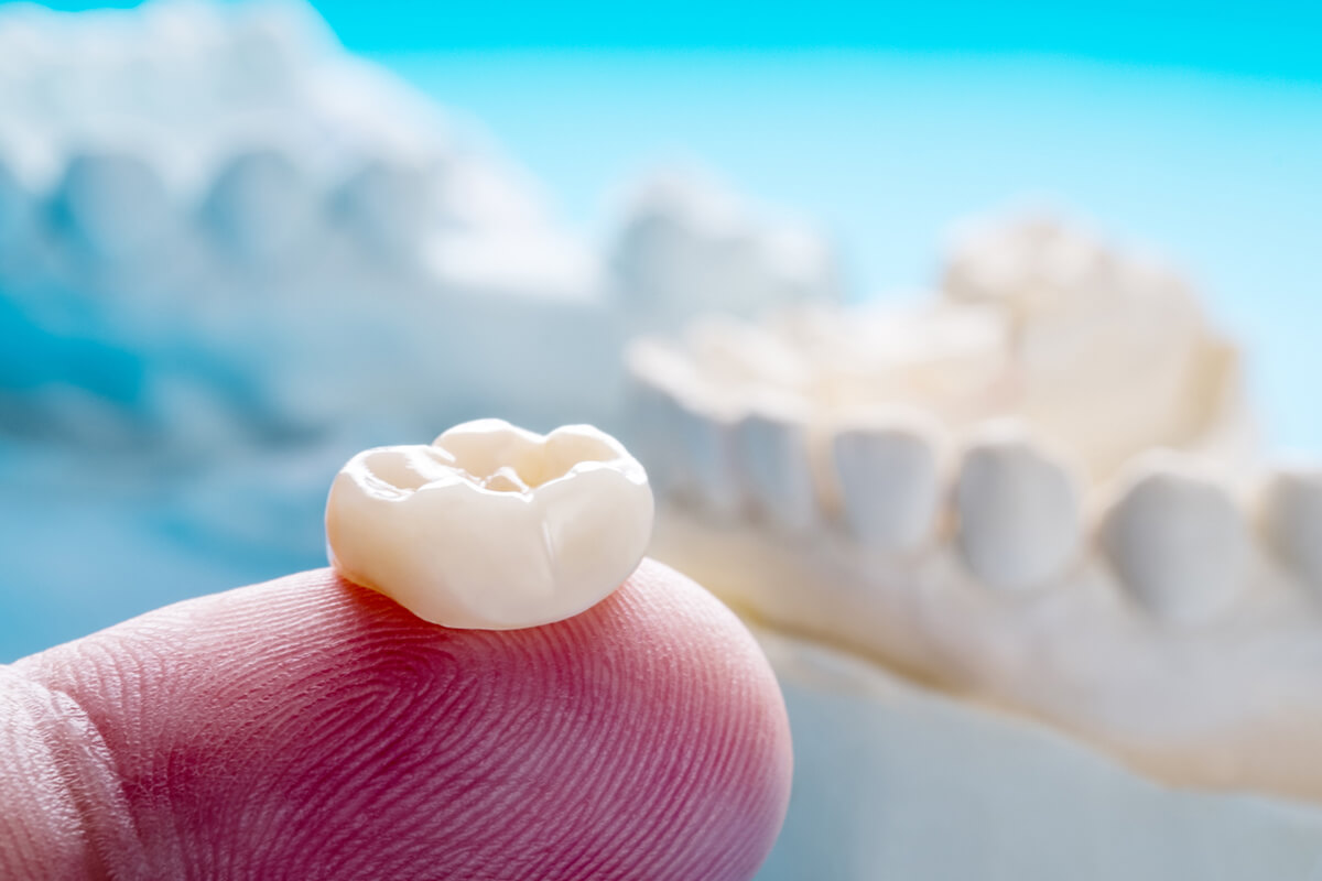 What Are Dental Crowns Made Of?