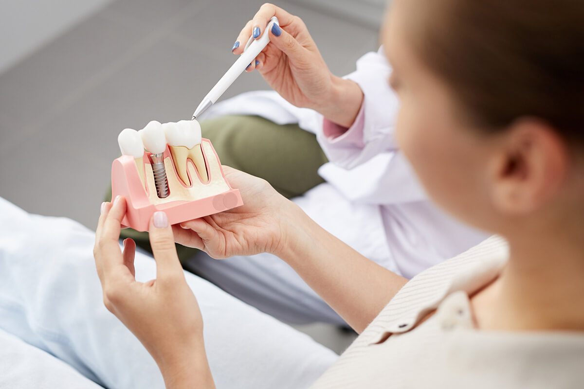 model of a dental crown